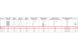 Алюмінева двухсекційна драбина VIRASTAR DUOMAX 2x8 сходинок (VDL028) Фото 10 з 10